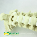 TF11 (12322) Modèles orthopédiques d&#39;anatomie normale Colonne vertébrale cervicale avec Occipital